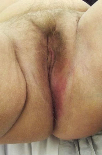 Homemade Set | Mrs. RObinson | Lacey | Anal Group Homemade Set | Mrs. RObinson | Lacey | Anal Group